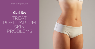 How To Take Care Of Post-Partum Skin Problems